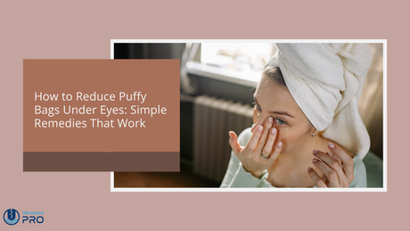 how to reduce puffy bags under eyes