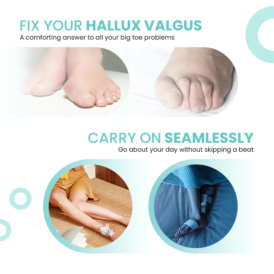UltraCare PRO bunion corrector for hallux valgus pain relief and daily wear comfort